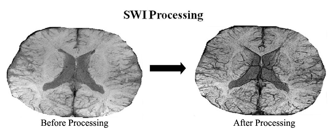 SWI Reconstruction