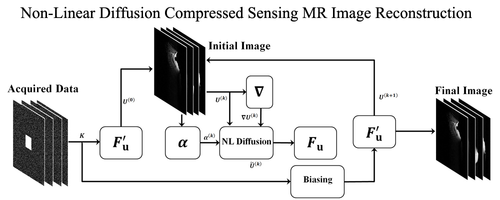 Compressed Sensing