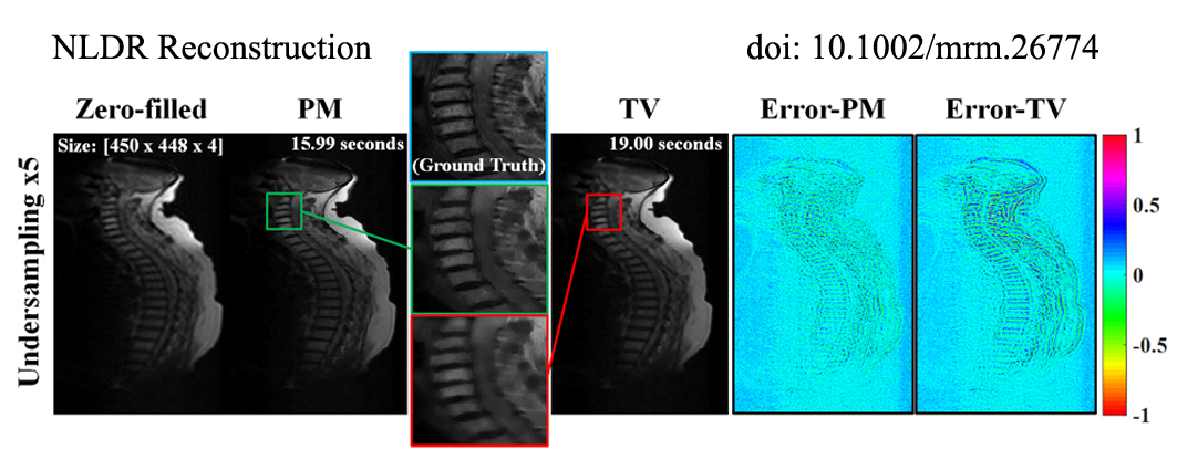 Compressed Sensing