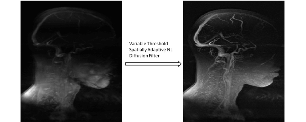 Phase Contrast MRI